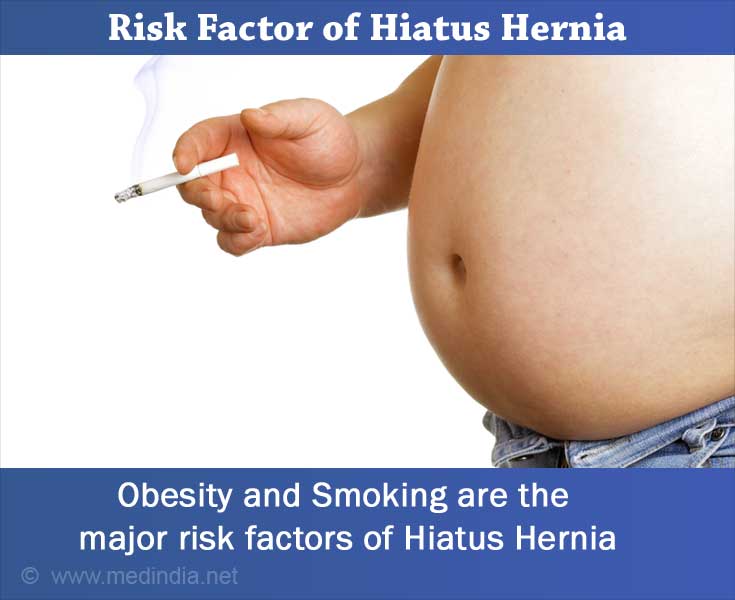 Obesity And Smoking - Major Risk Factors of Hiatus Hernia Obesity And Smoking - Major Risk Factors of Hiatus Hernia