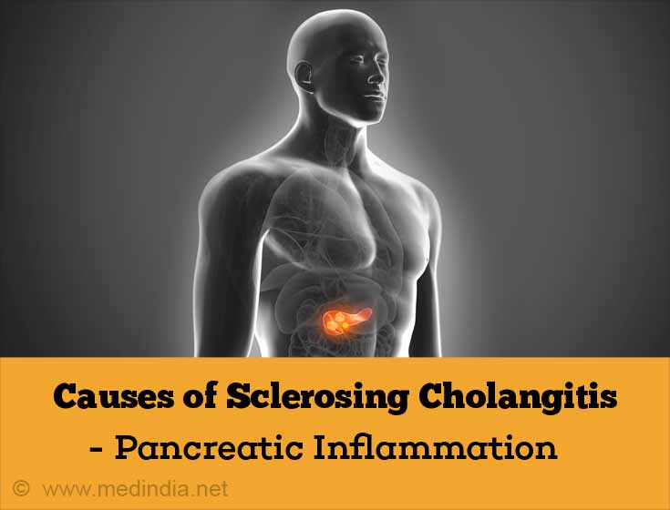 Causes of Sclerosing Cholangitis - Pancreas Inflammation Causes of Sclerosing Cholangitis - Pancreas Inflammation