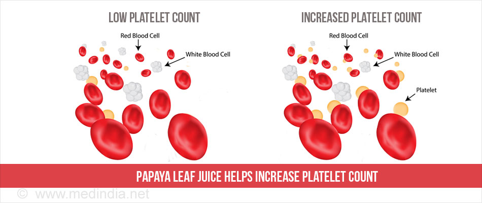 Papaya Leaf Juice to Increase Platelet Count Papaya Leaf Juice to Increase Platelet Count
