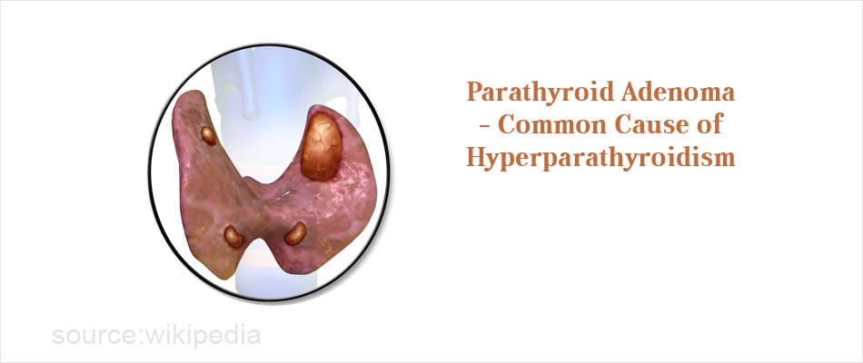 causes-of-kidney-damage-painscale