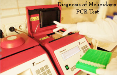 PCR Test for Melioidosis PCR Test for Melioidosis