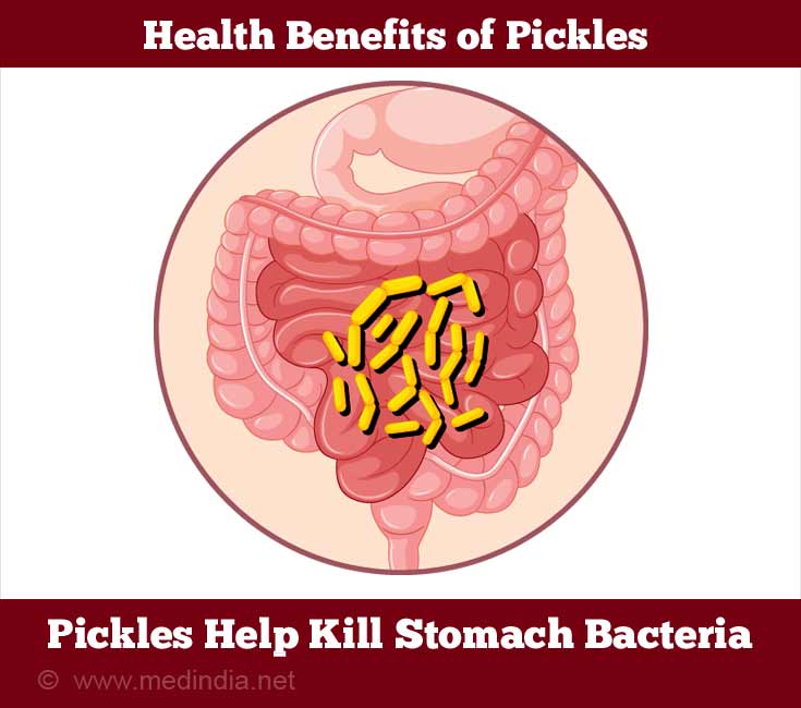 Pickles Help Kill Stomach Bacteria Pickles Help Kill Stomach Bacteria