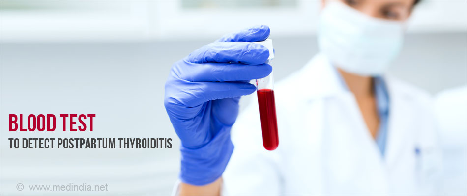 Postpartum Thyroiditis Diagnosis Blood Test Postpartum Thyroiditis Diagnosis Blood Test