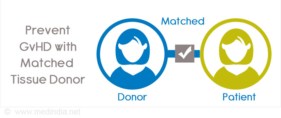 Prevent GvHD with Matched Tissue Donor Prevent GvHD with Matched Tissue Donor