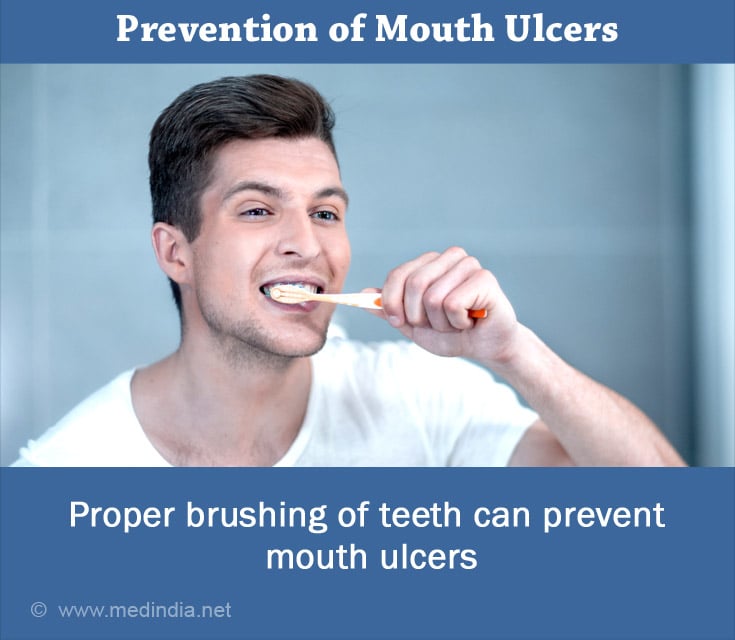 Mouth | Oral Ulcers - Causes, Symptoms, Diagnosis, Treatment And Prevention