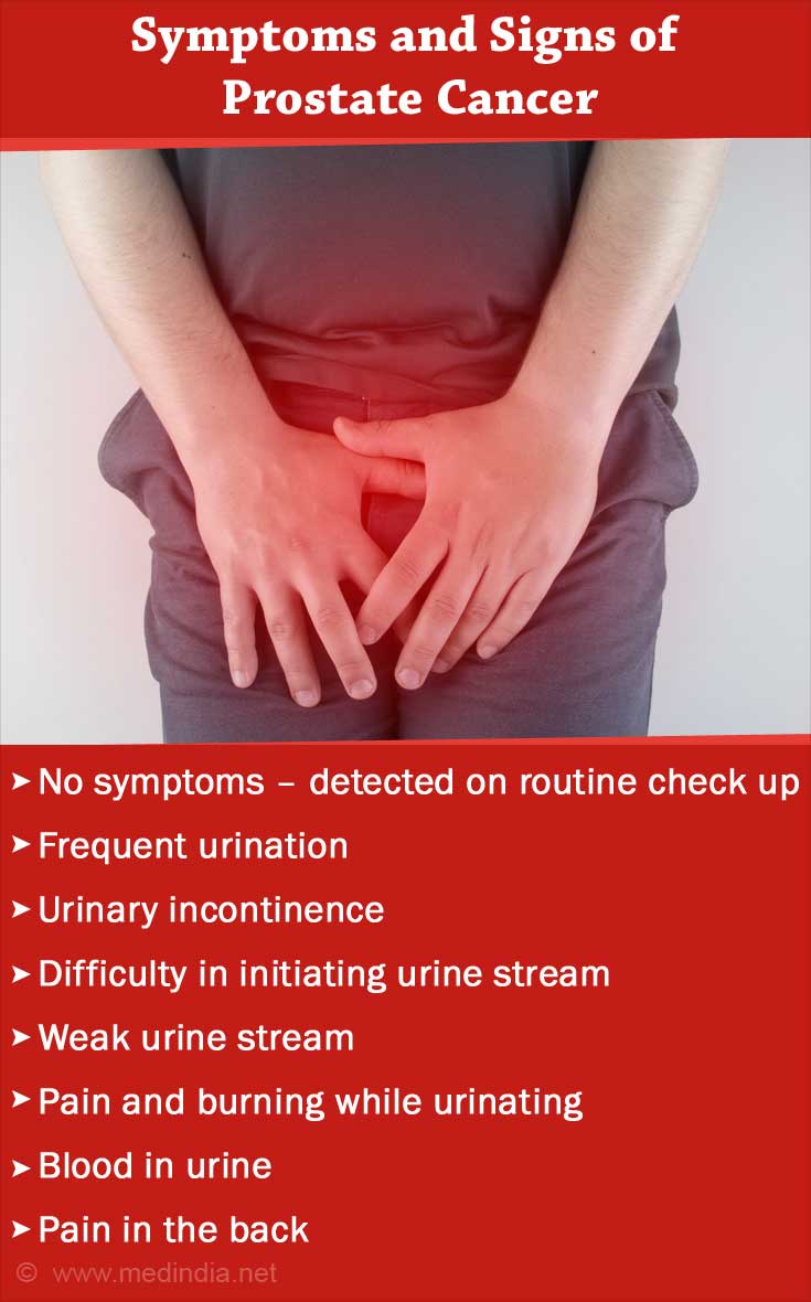 Medical Management Of Prostate Cancer