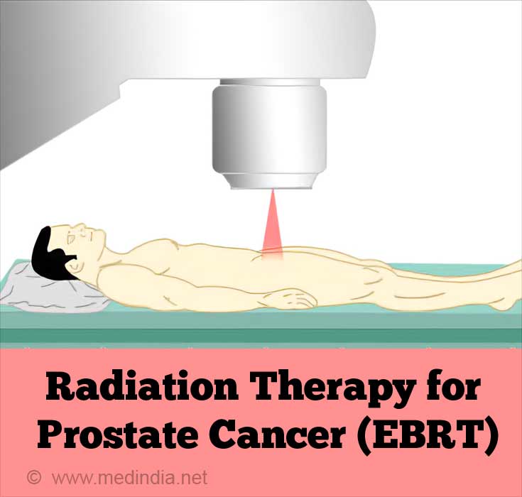 Drugs For Prostate Cancer Treatment Side Effects And Precautions 3308