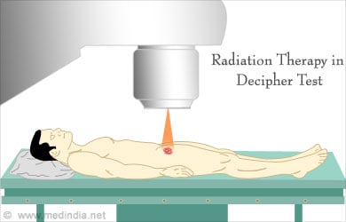 Decipher Test for Prostate Cancer - Indications, Procedure & Results