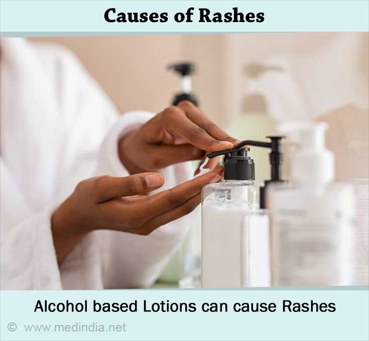 Causes of Rashes Causes of Rashes