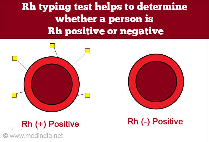 rh factor positive means