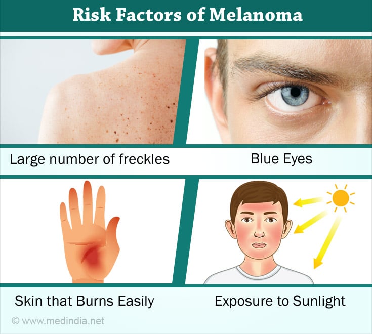 Risk Factors of Melanoma