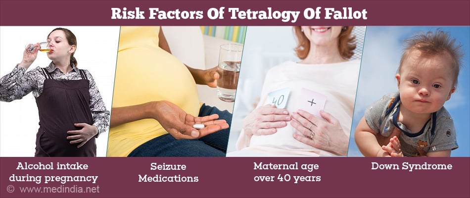 Risk Factors of Tetralogy of Fallot Risk Factors of Tetralogy of Fallot