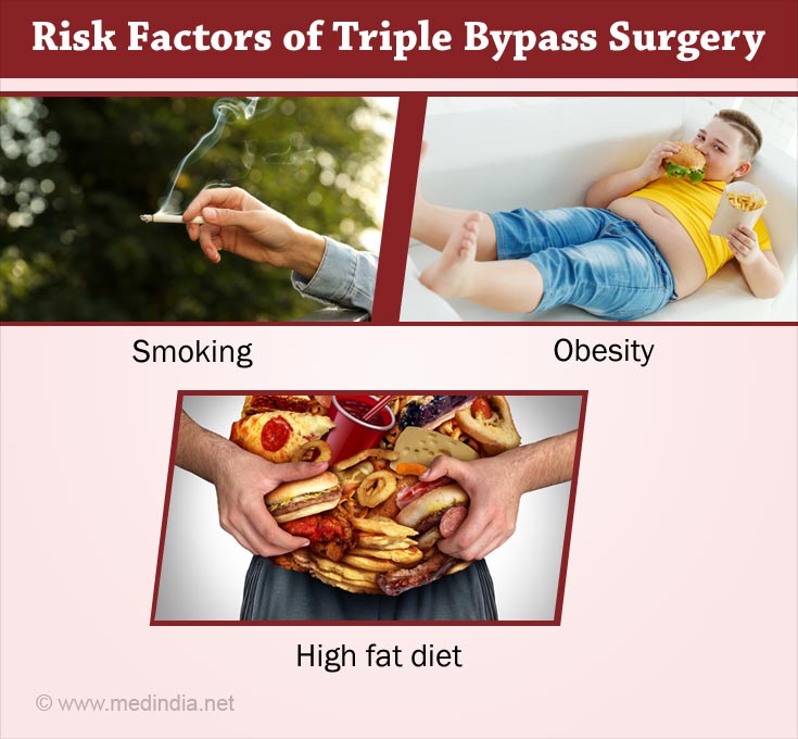 Risk Factors of Triple Bypass Surgery