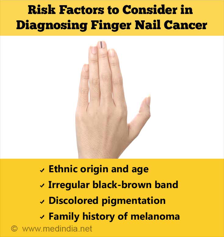 Subungual Melanoma Fingernail Cancer Causes Symptoms Diagnosis Treatment And Prevention