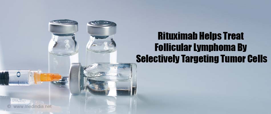 Rituximab Side Effects Usmle