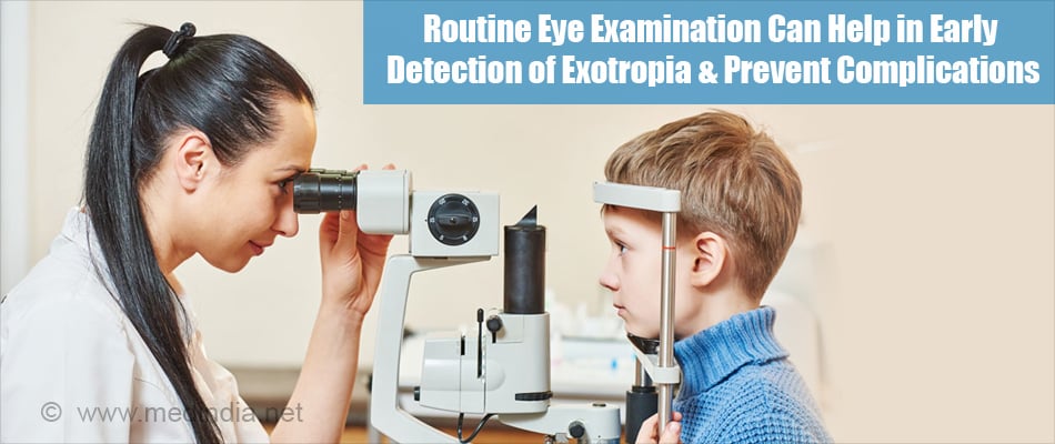 Exotropia Types Symptoms Diagnosis Treatment Prevention