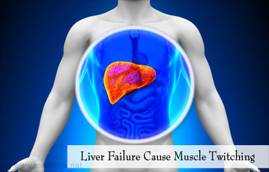 Causes of Muscle Twitching � Liver Failure Causes of Muscle Twitching � Liver Failure
