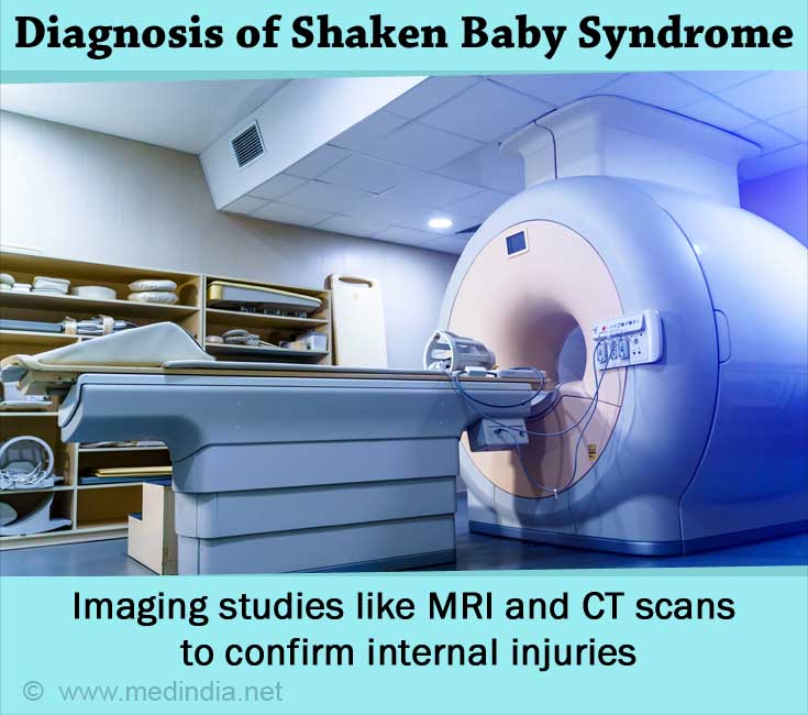 Shaken Baby Syndrome | Abusive Head Trauma - Causes, Symptoms ...