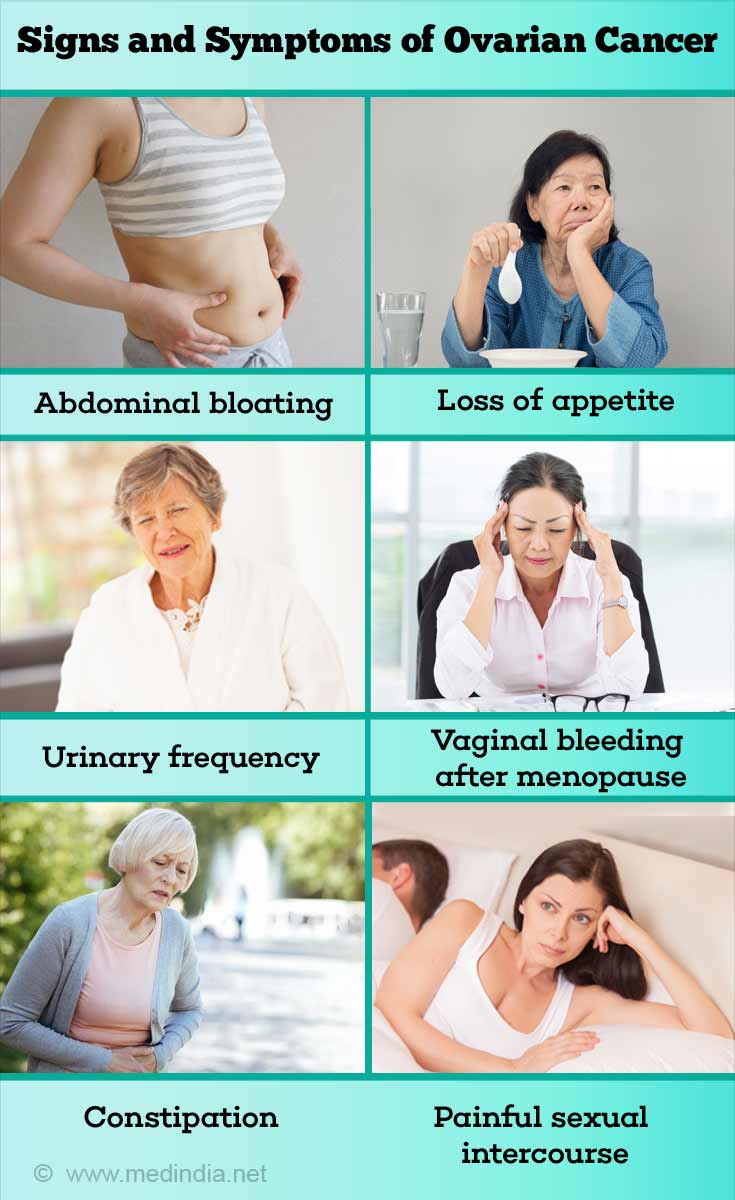 Signs and Symptoms of Ovarian Cancer Signs and Symptoms of Ovarian Cancer