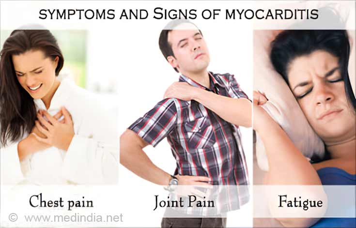 myocarditis-types-causes-symptoms-complications-treatment-prognosis