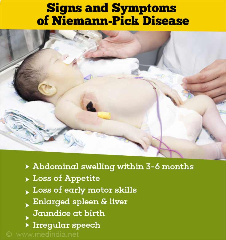 NiemannPick Disease Types, Causes, Symptoms, Diagnosis & Treatment