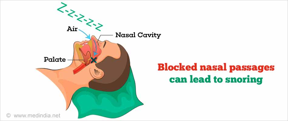 Causes of Snoring: Sleep Apnea Causes of Snoring: Sleep Apnea
