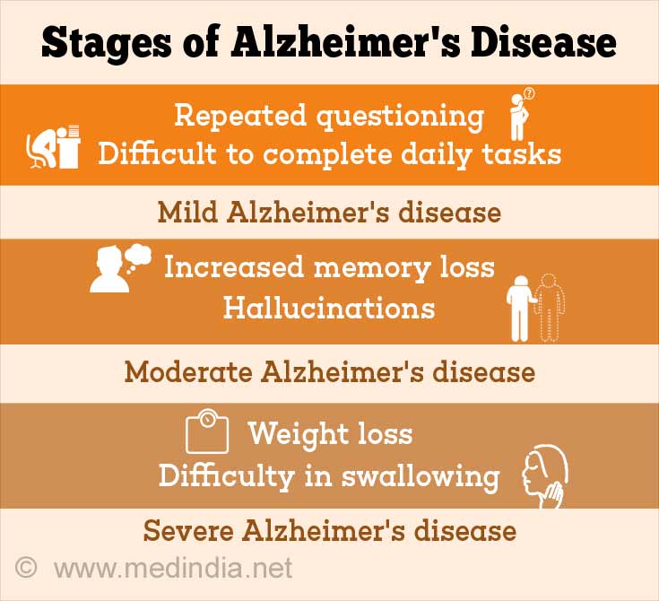 Stages Of Alzheimer S Disease Chart