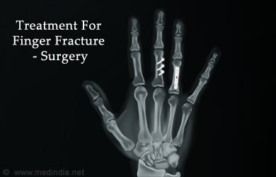 Surgery for Finger Fracture Surgery for Finger Fracture
