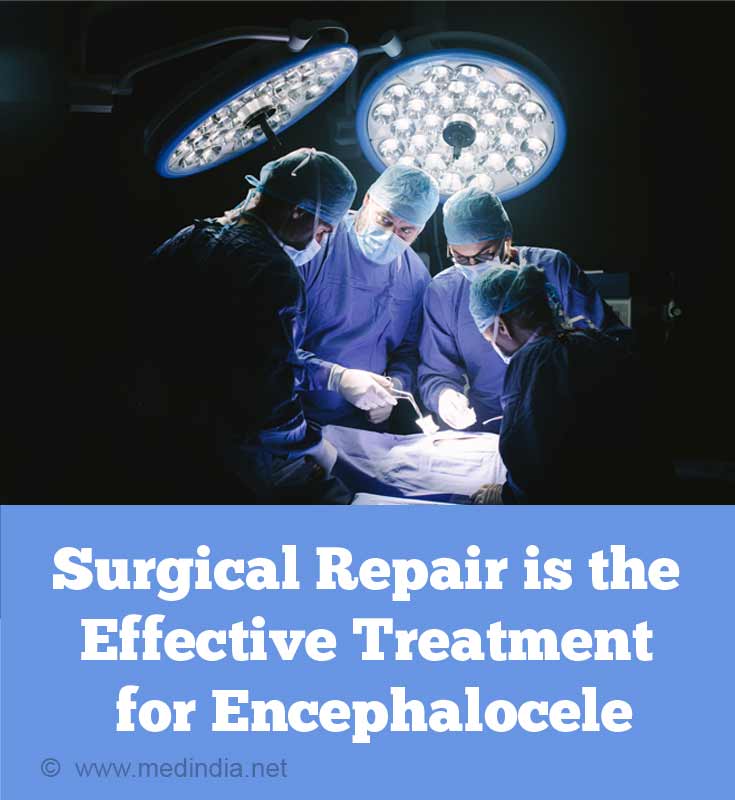 Surgical Repair is the Effective Treatment for Encephalocele Surgical Repair is the Effective Treatment for Encephalocele
