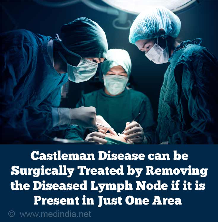 Castleman Disease can be Surgically Treated by Removing the Diseased Lymph Node if it is Present in Just One Area Castleman Disease can be Surgically Treated by Removing the Diseased Lymph Node if it is Present in Just One Area