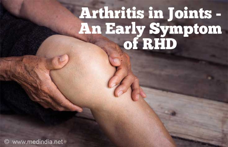 Swelling and Pain in the Joints Swelling and Pain in the Joints