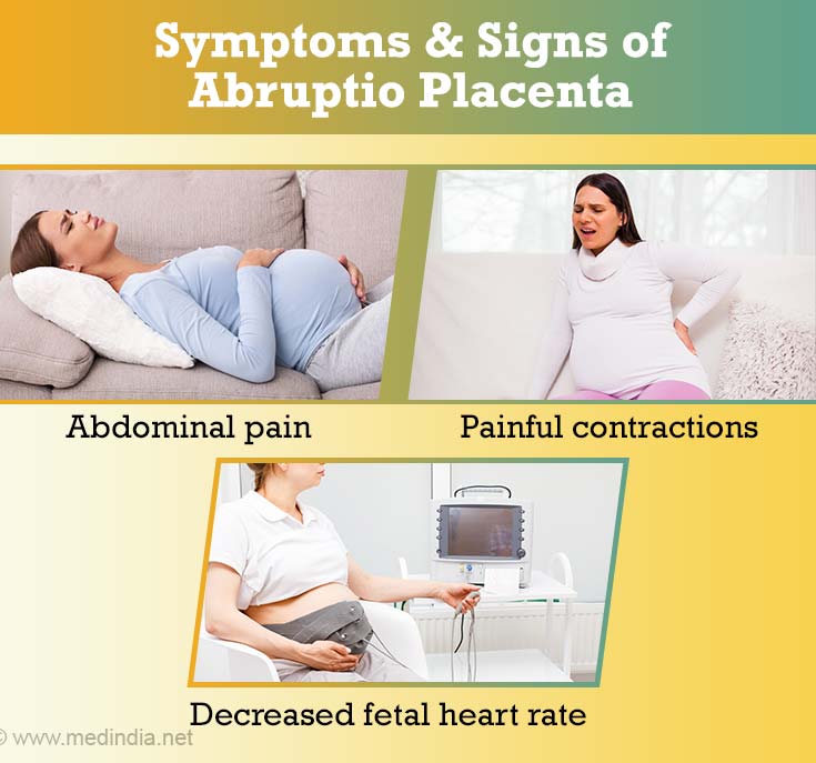 Placental Abruption Abruptio Placentae Causes Clinical Features Diagnosis And Management 