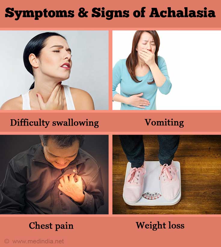 Symptoms and Signs of Achalasia Symptoms and Signs of Achalasia
