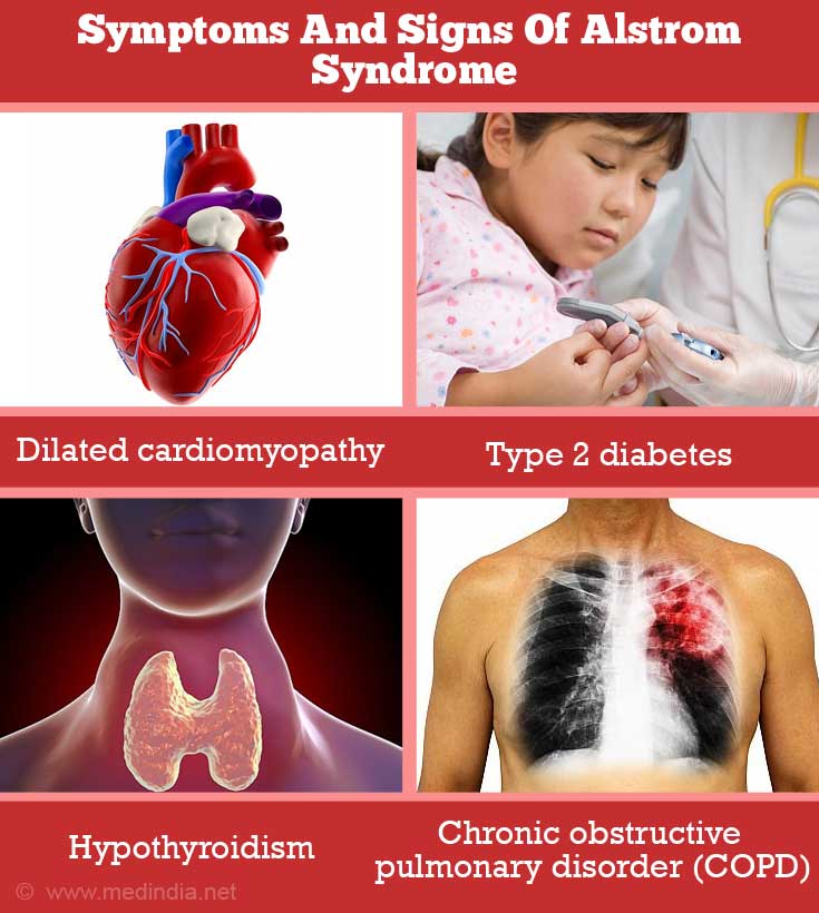 Alström Syndrome | Alström–Hallgren Syndrome - Causes, Symptoms ...