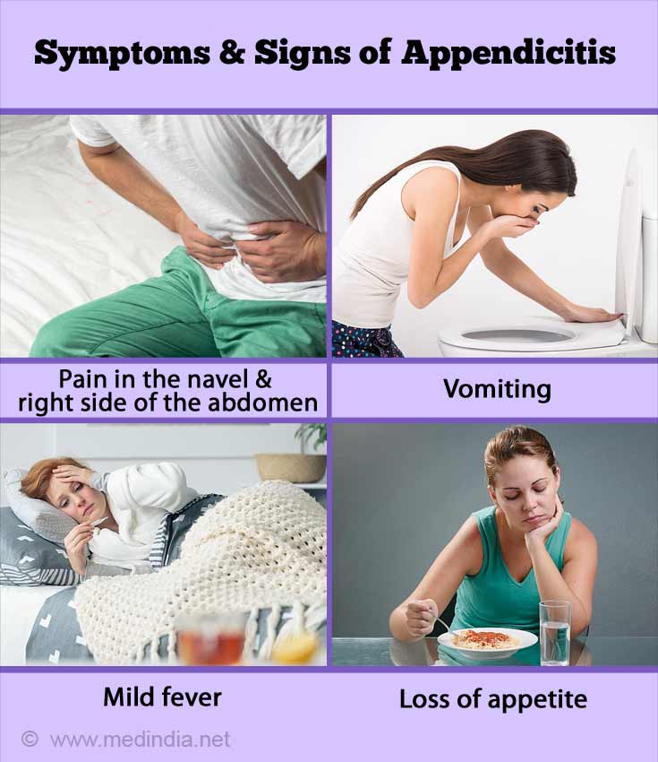 Appendicitis Causes Symptoms Diagnosis Treatment Complications And Prevention 9468