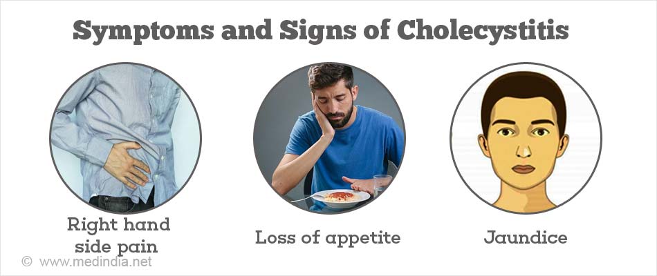 Cholelithiasis Cholecystitis Symptoms Causes Complica - vrogue.co