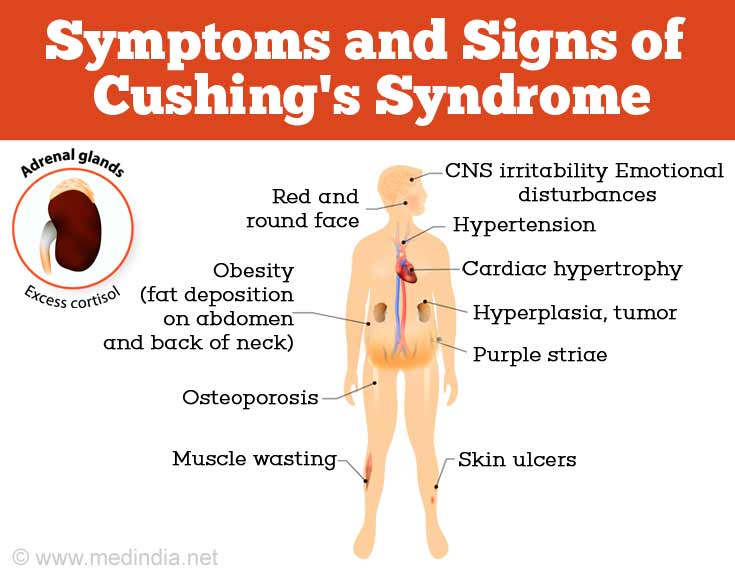 Cushing S Syndrome Causes Symptoms Diagnosis And Management