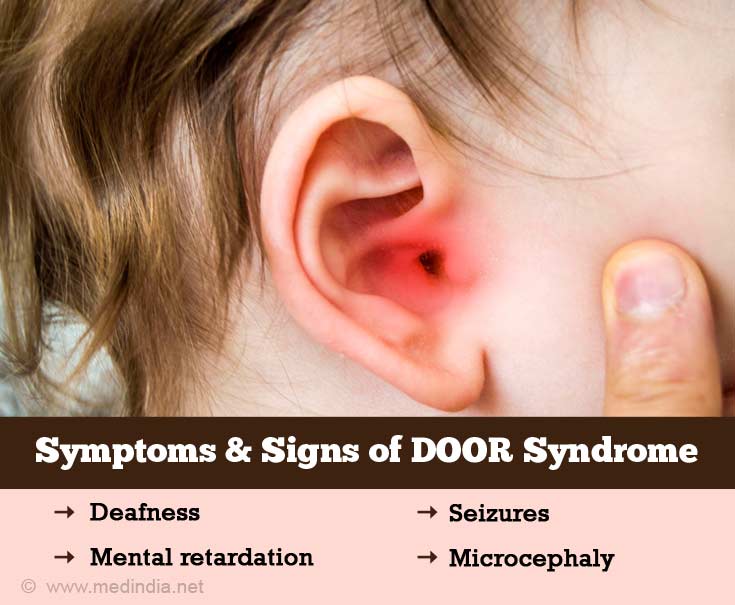 Symptoms and Signs of DOOR Syndrome