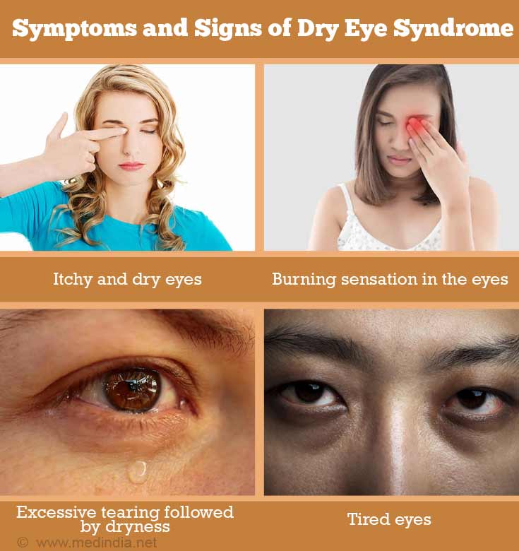 Symptoms and Signs of Dry Eye Syndrome