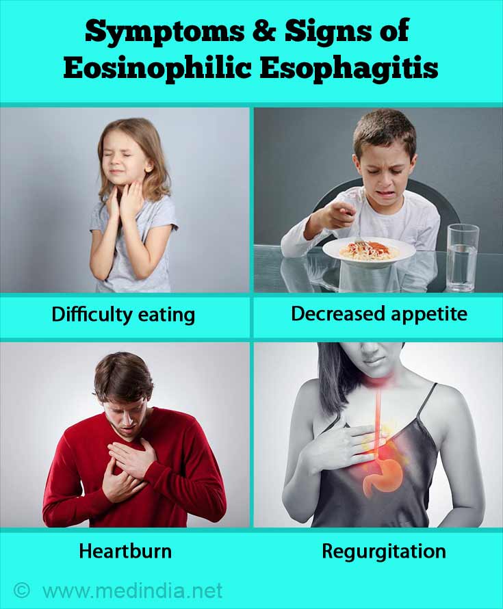 Eosinophilic Esophagitis Eoe Allergic Esophagitis Causes