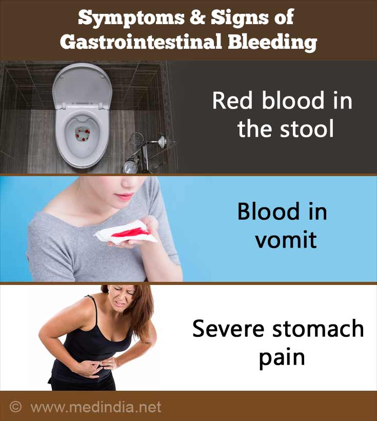 Gastrointestinal Bleeding (GI Bleed) - Causes, Symptoms And Signs