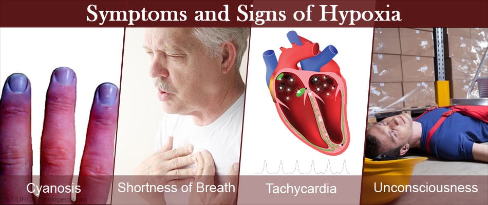 Symptoms Of Hypoxia In Elderly