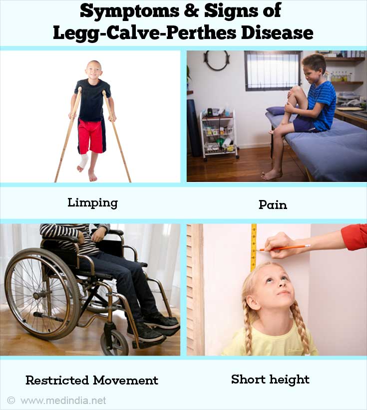 Legg-Calvé-Perthes Disease - Childhood Bone Disorder