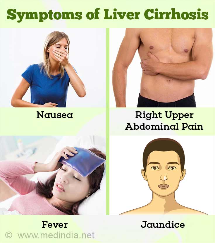 Early Cirrhosis Symptoms