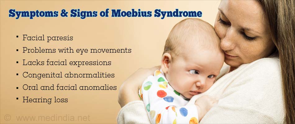 Symptoms & Signs of Moebius Syndrome Symptoms & Signs of Moebius Syndrome