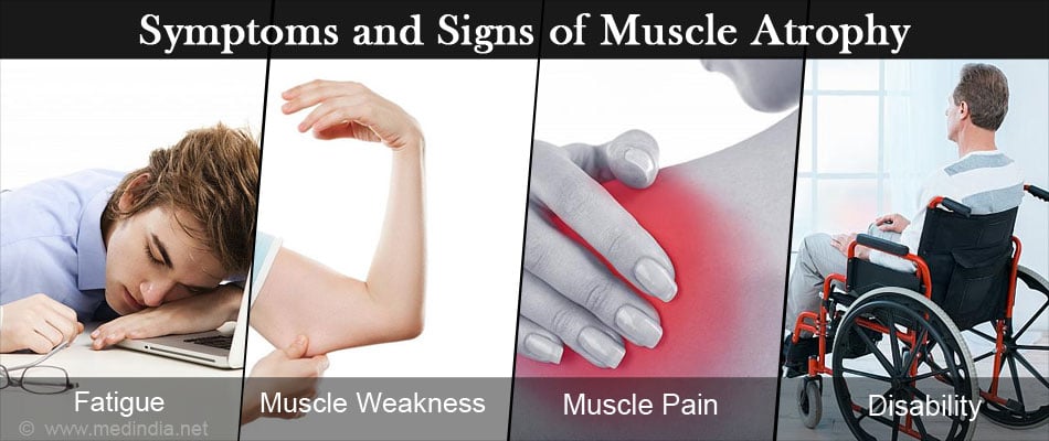 Muscle Atrophy - Causes, Symptoms, Diagnosis, Treatment & Prevention