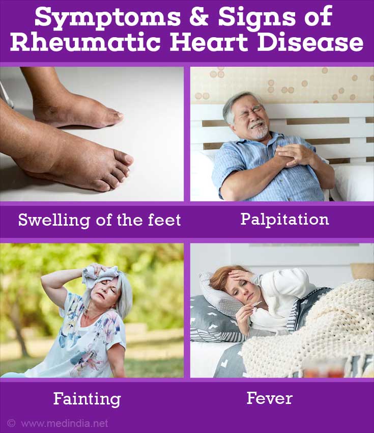 Rheumatic Heart Disease (RHD) - Causes, Risk factors, Symptoms