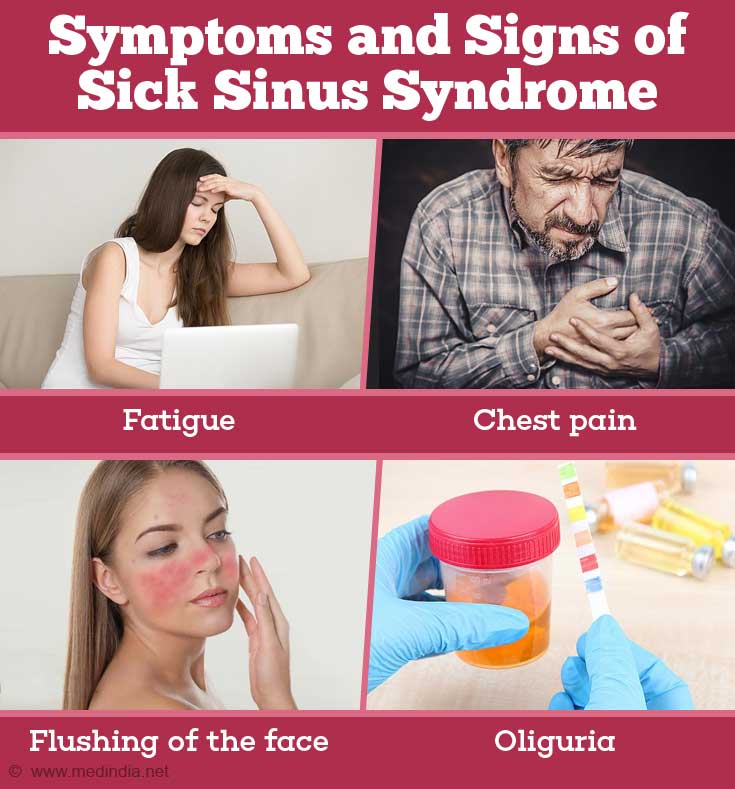 Sick Sinus Syndrome Causes Symptoms Diagnosis Treatment Prevention