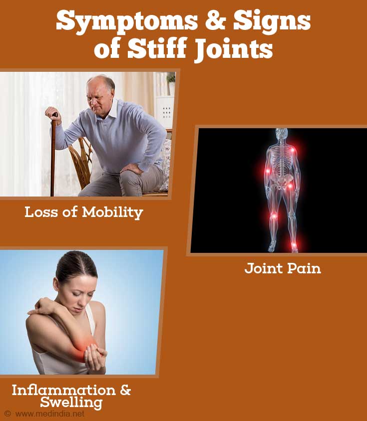 Is Stiffness A Sign Or Symptom