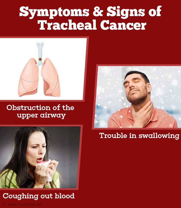 Tracheal Cancer (Cancer of the Windpipe) - Causes, Symptoms, Diagnosis ...